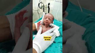 Icu care  massage and sponging preterm baby newbornbaby cutebaby cute baby pretermbaby [upl. by Soma]