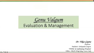 Genu Valgus  Evaluation and Management  Dr Vikas Gupta [upl. by Hsenid]