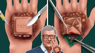 ASMR Animation Remove the Microsoft chip out of Bill Gates hands  WOW Brain Satisfying Video [upl. by Crain]