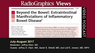 Beyond the Bowel Extraintestinal Manifestations of Inflammatory Bowel Disease [upl. by Lorelie688]