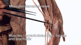 Anatomy Series Innervation of the Upper Limb by Dr Shakti Chandra [upl. by Latton]