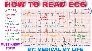 How To Read An ECG [upl. by Ahseele]