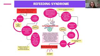 quotRefeeding syndrome in paediatric patients with severe acute malnutritionquot  Natalie Heydenrych [upl. by Mairb874]