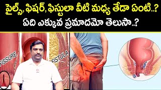 పైల్స్ ఫిషర్స్ ఫిస్టులా Difference Between Piles Fissures and Fistula In Telugu  Dr Pawan Kumar [upl. by Arlana]