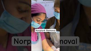 Norplant Removal — Full video click above👆🏻 contraceptives birthcontrol norplant shorts [upl. by Jb]