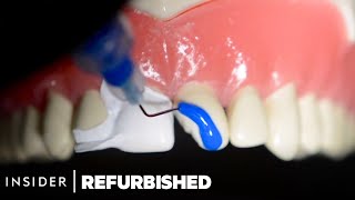 How Damaged Teeth Are Professionally Restored  Refurbished  Insider [upl. by Agata]