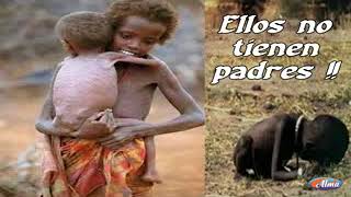 Los niños de África mueren de hambre mira este video y te cambiara la vida [upl. by Pegasus]