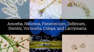 Microscopic Organisms in a Drop of Pond Water  Episode 2 [upl. by Mahgem10]