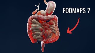 The Low FODMAP Diet Beginner’s Guide [upl. by Ahsii127]