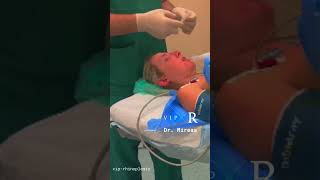 FULL Surgery process before General Anesthesia👃🏻IntubationSleep amp Recovery Αναισθησία amp ξύπνημα [upl. by Ecyt798]