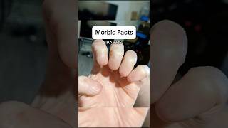 Morbid facts you’ve got to see morbidfacts interesting history [upl. by Jehiah]