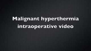 Malignant Hyperthermia Intraoperative video  Case Report [upl. by Zhang]