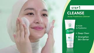 Acnes 3 Simple Steps to AcneFree Skin [upl. by Repsac25]