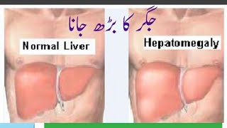 What is Hepatomegaly in URDU Hindima hassan [upl. by Eri]