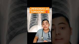 ¿Personas sin corazón😱 ECTÓPIA CORDIS 🫀interesting medicina foryou aprender medshorts med [upl. by Enael691]