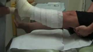 Wound Management  How to apply a single layer high compression bandage [upl. by Pine323]