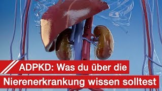 ADPKD  Wissen über Zystennieren Symptome Diagnose Therapie und Alltag [upl. by Ettevets930]