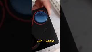 CRP test procedure  CRP blood test  medicalstudent youtube shorts [upl. by Atteyram]