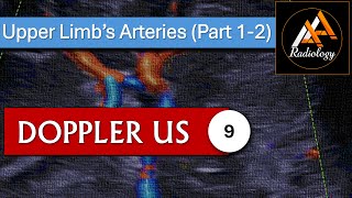 9  Upper Limbs Arteries Part 12 [upl. by Aiselad766]