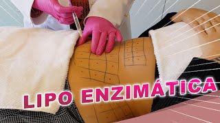 Resultados da Lipo Enzimática  Dr Luciane Bravi Explica [upl. by Atima]