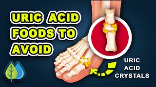 Top 10 uric acid foods to AVOID  Worst uric acid foods for GOUT attacks [upl. by Hsima]