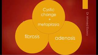 Breast fibrocystic change fibroadenosis sonomammography MRI [upl. by Ahsekyt]