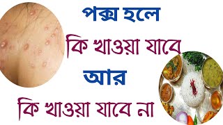 পক্স হলে কি খাওয়া যাবে  pox hole ki khabo [upl. by Kos]