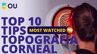 Top 10 Tips en Topografía Corneal [upl. by Alikahs716]