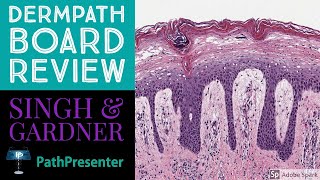 Dermpath Board Review 100 Classic Cases [upl. by Dru]