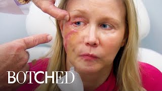 2 MAJOR Predatory Procedure Makeovers on Botched  E [upl. by Aicerg]