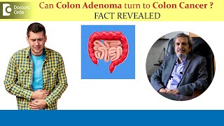 Can Colon Adenoma turn to Colon Cancer  Colon Polyp Removal Dr Rajasekhar M R  Doctors Circle [upl. by Strait]