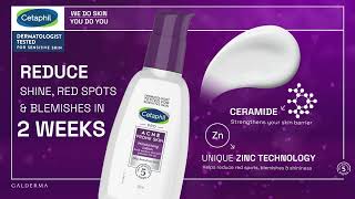 Acne Woes Hydrate and strengthen  try Cetaphil [upl. by Aeslek]