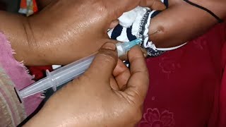 Child Cefepime 500mg Ultraprime amp Flucloxin injection Video 24 Ep 111 Injection Tips [upl. by Botnick]