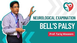 Bells Palsy  Neurological Examination by ProfTariqWaseem medical education medicalexamination [upl. by Siraval]