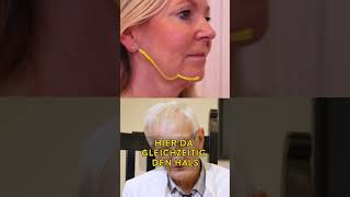 Facelift bei 51jähriger Patientin Vorher amp 5 Wochen nach OP facelift plastischechirurgie [upl. by Letnuahc]