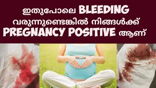 Early Pregnancy bleeding Deechus world Malayalam [upl. by Enomaj]