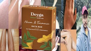 Deyga Neem Turmeric Bath Bar  Honest Review [upl. by Redle]