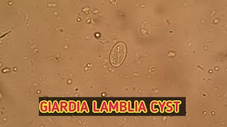 Giardia lamblia cyst under microscope Best clear view [upl. by Kirsti605]