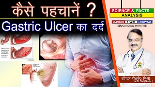 कैसे पहचानें गैस्ट्रिक अलसर का दर्द  GASTRIC ULCER PAIN [upl. by Nyleimaj]