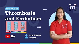 Thrombosis and Embolism with Dr Priyanka Sachdev [upl. by Aicatsal324]