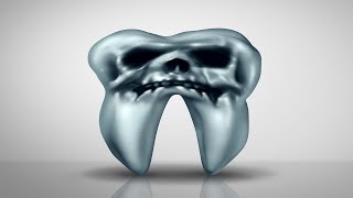 Root Canals Are Root Canals A Root Cause of Cancer amp Autoimmune Disease [upl. by Igig]