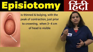 Episiotomy in Hindi  Perineotomy  Nursing Lecture [upl. by Ronacin]