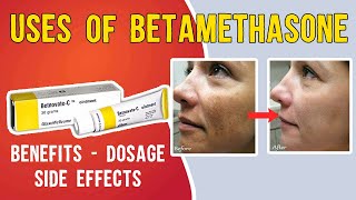 What is Uses of Betamethasone Betaderm Betnovate  betnovate c skin cream  Benefits Dosage [upl. by Lokim105]