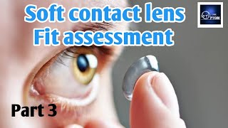 Soft contact lens fitting assessment  Contact lens fitting guide Part 3 eyecareoptom5506 lens [upl. by Ybok]