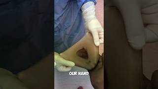 How to put gloves on for surgery shorts [upl. by Nalaf]