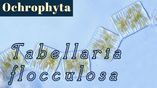 Tabellaria flocculosa Bacillariophyceae or Diatoms [upl. by Stauder]