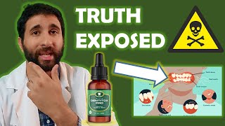 Dentitox Pro Reviews  🔴 My Honest Dentitox Pro Supplement Review 2022 🔴  Dentitox Pro Review [upl. by Oidale]