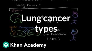 Lung cancer types  Respiratory system diseases  NCLEXRN  Khan Academy [upl. by Belvia743]