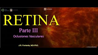 Retina Parte III Oclusiones Vasculares [upl. by Isaiah198]