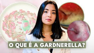 GARDNERELLA O QUE É SINTOMAS DIAGNÓSTICO TRATATAMENTO E O QUE FAZER SE ELA VOLTAR [upl. by Perrie368]